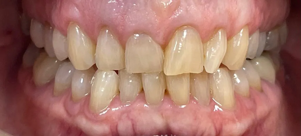 32999 dental professional consultation