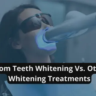 /img/32999-teeth-whitening-comparison.webp