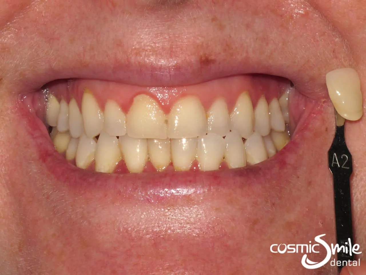 32999 whitening gel composition
