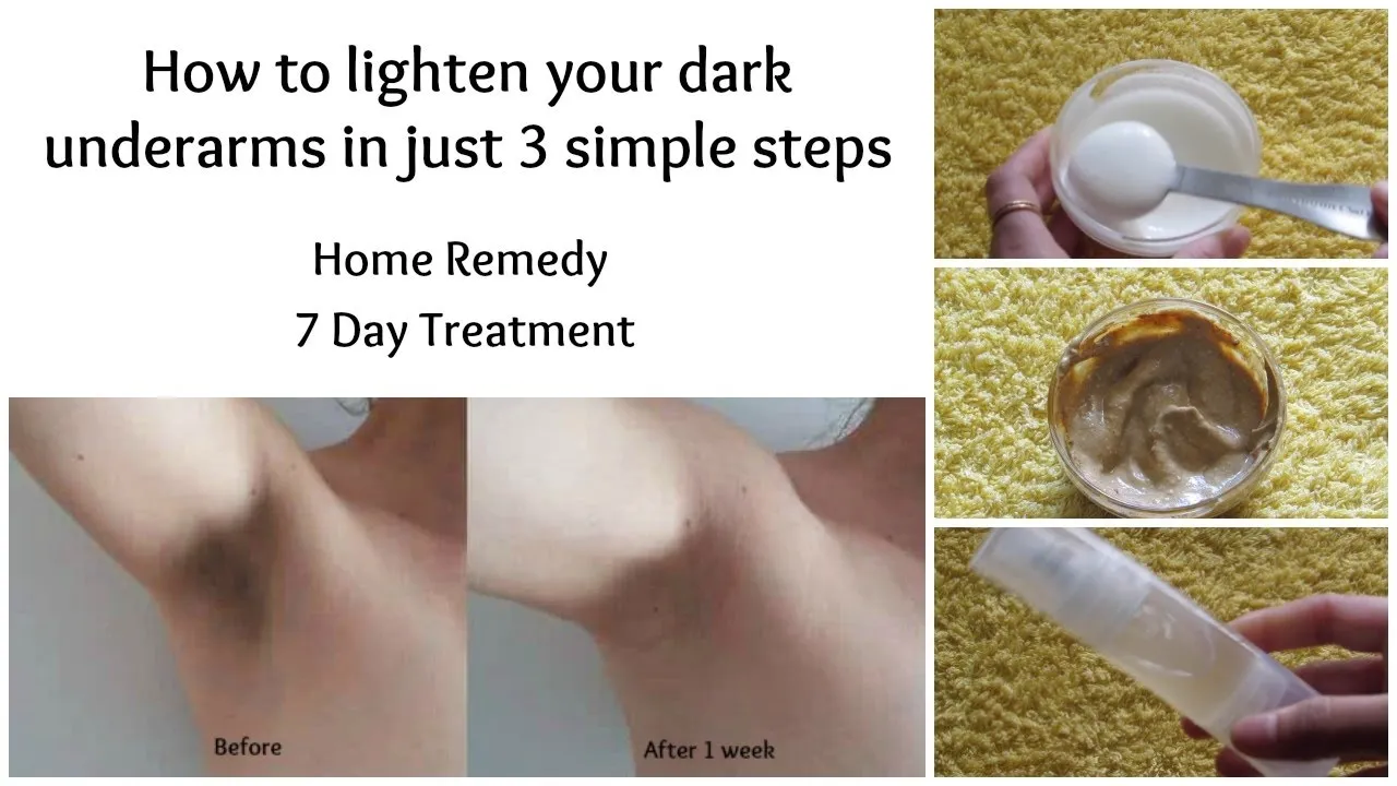 33001 underarm whitening home remedies 4