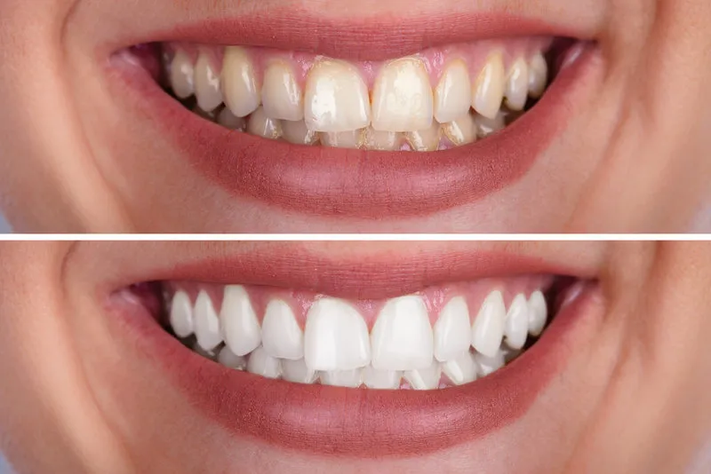 /img/33004-dentist-consultation.webp
