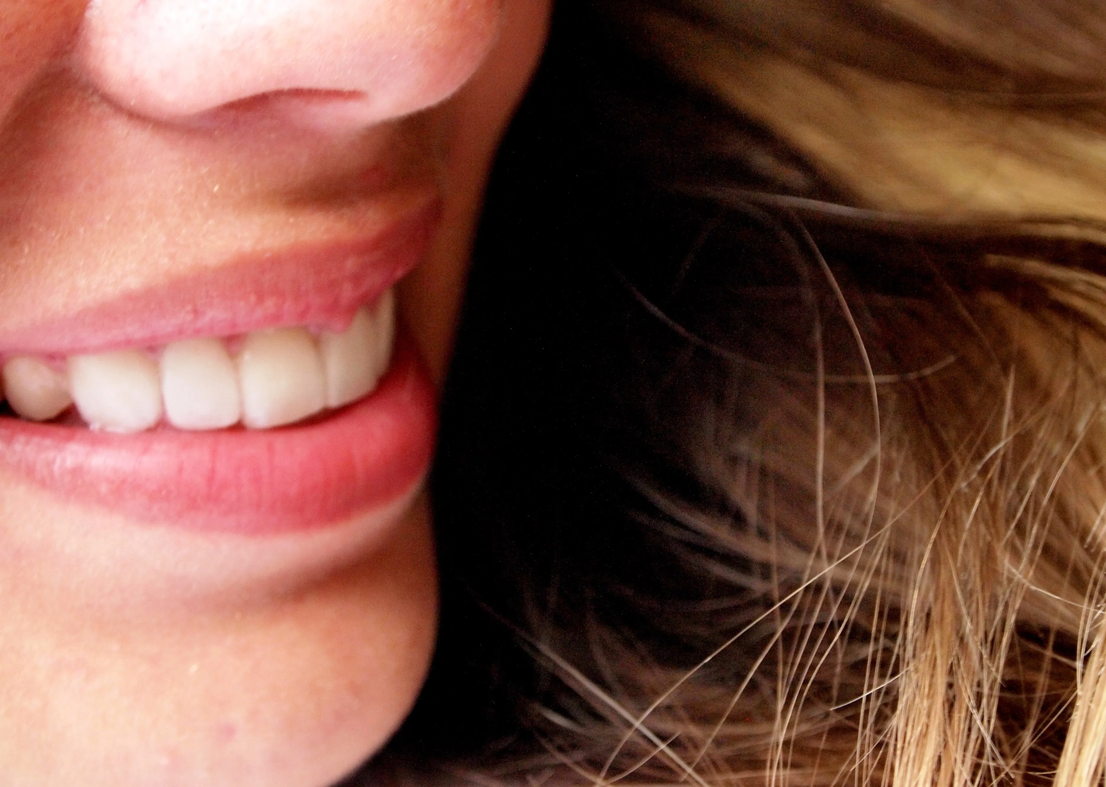 33011 teeth stains