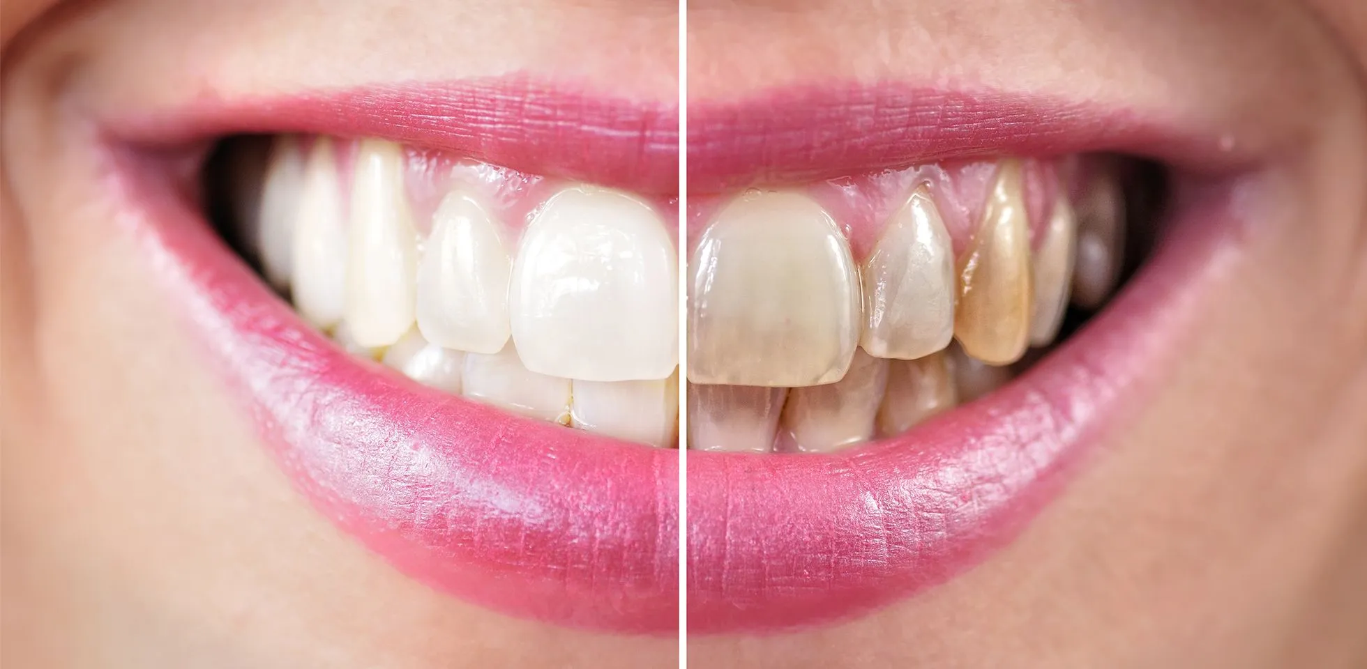 /img/33016-dental-health-check.webp