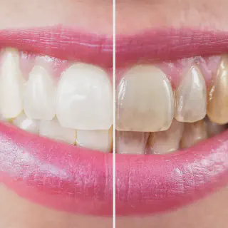 /img/33016-dental-health-check.webp