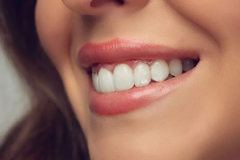 33017 teeth whitening gums image2