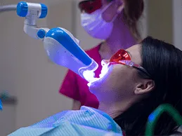 33018 zoom whitening calgary image4