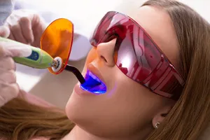33018 zoom whitening calgary image5