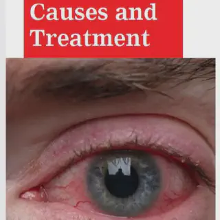 /img/33019-eye-doctor.webp