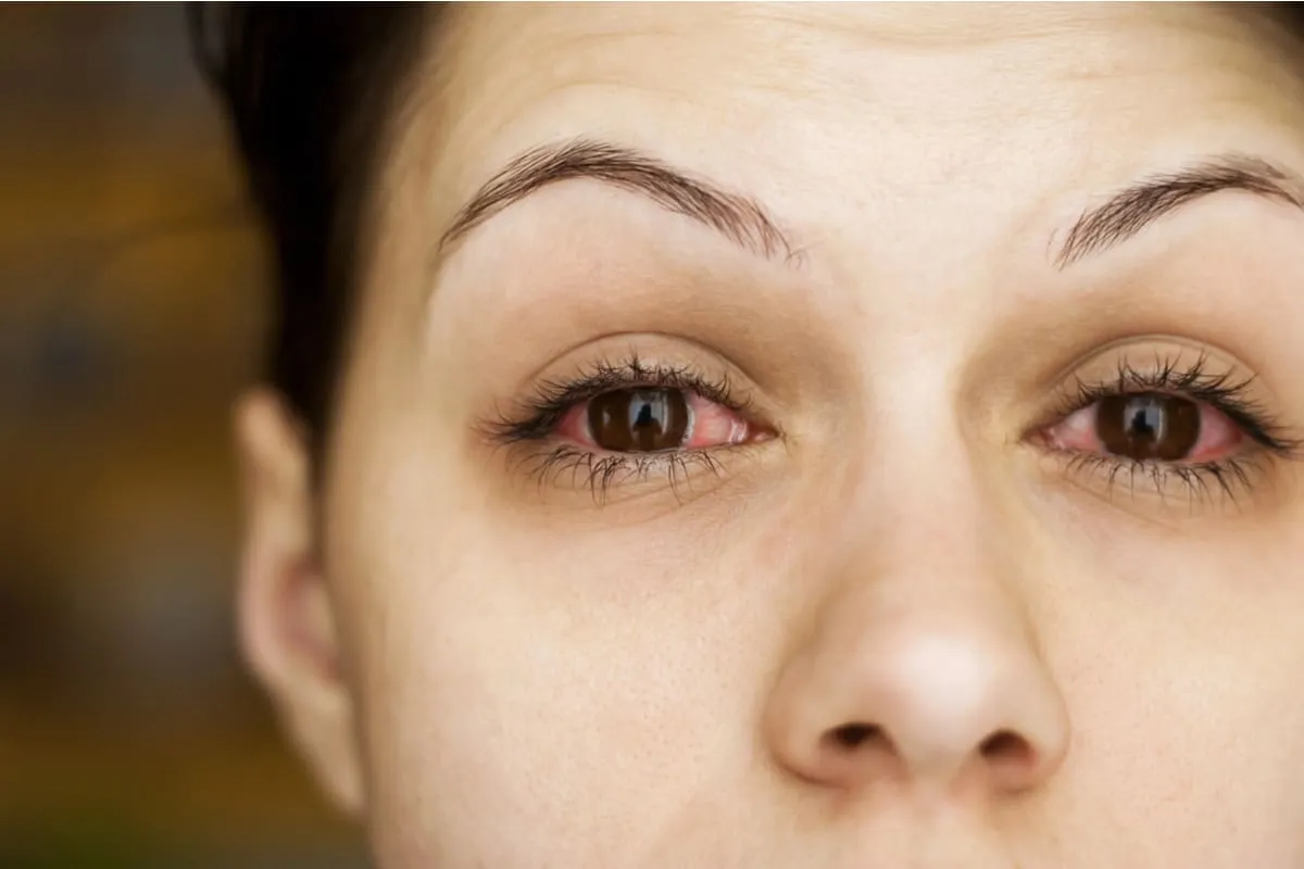33019 eye drops