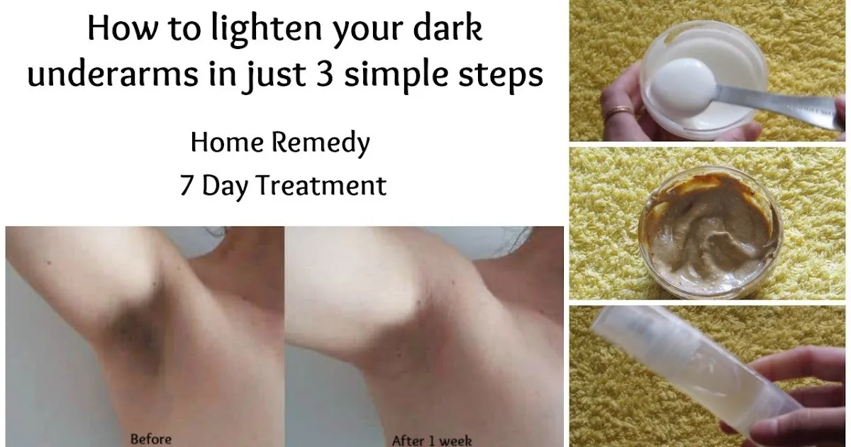 33028 turmeric paste underarms
