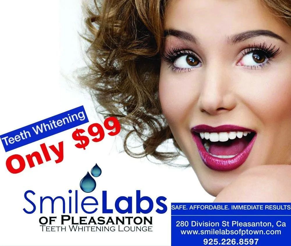 33030 at home teeth whitening