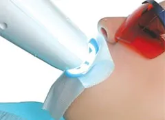 33030 in office teeth whitening