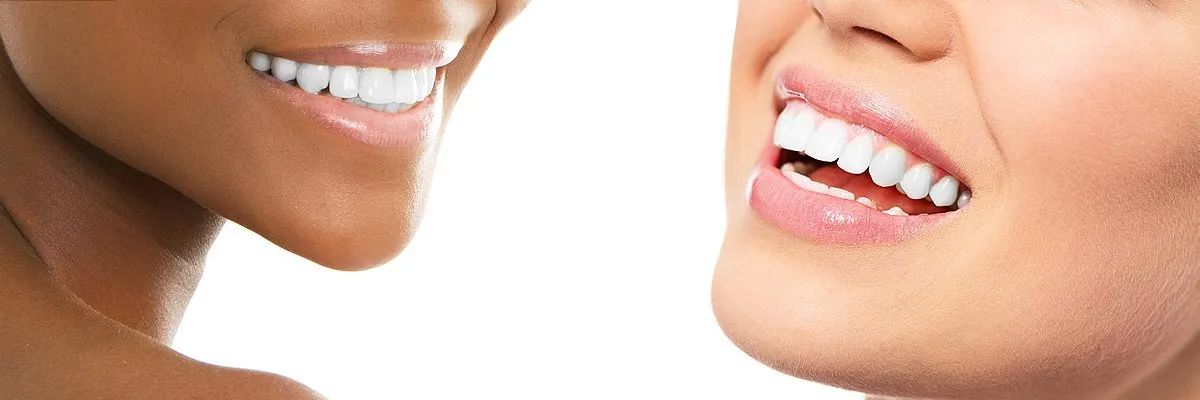 33030 teeth whitening walnut creek