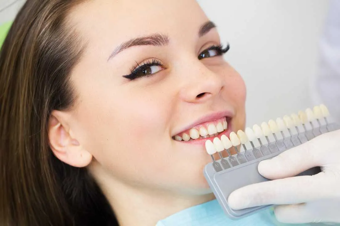 33034 take home whitening kit