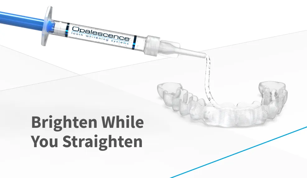 33035 teeth whitening and straightening image1