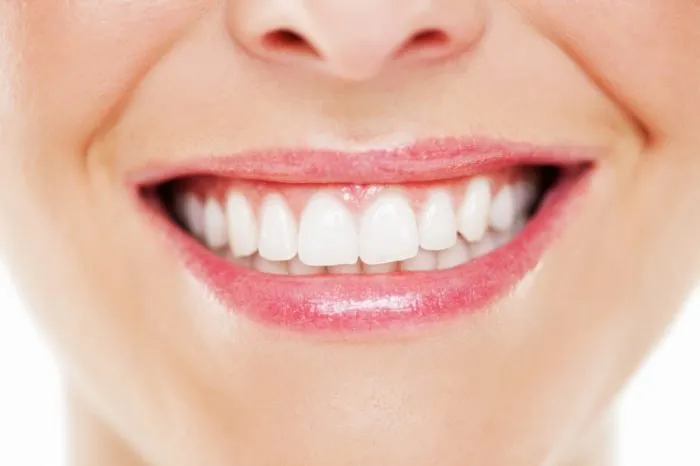 33035 teeth whitening and straightening image3