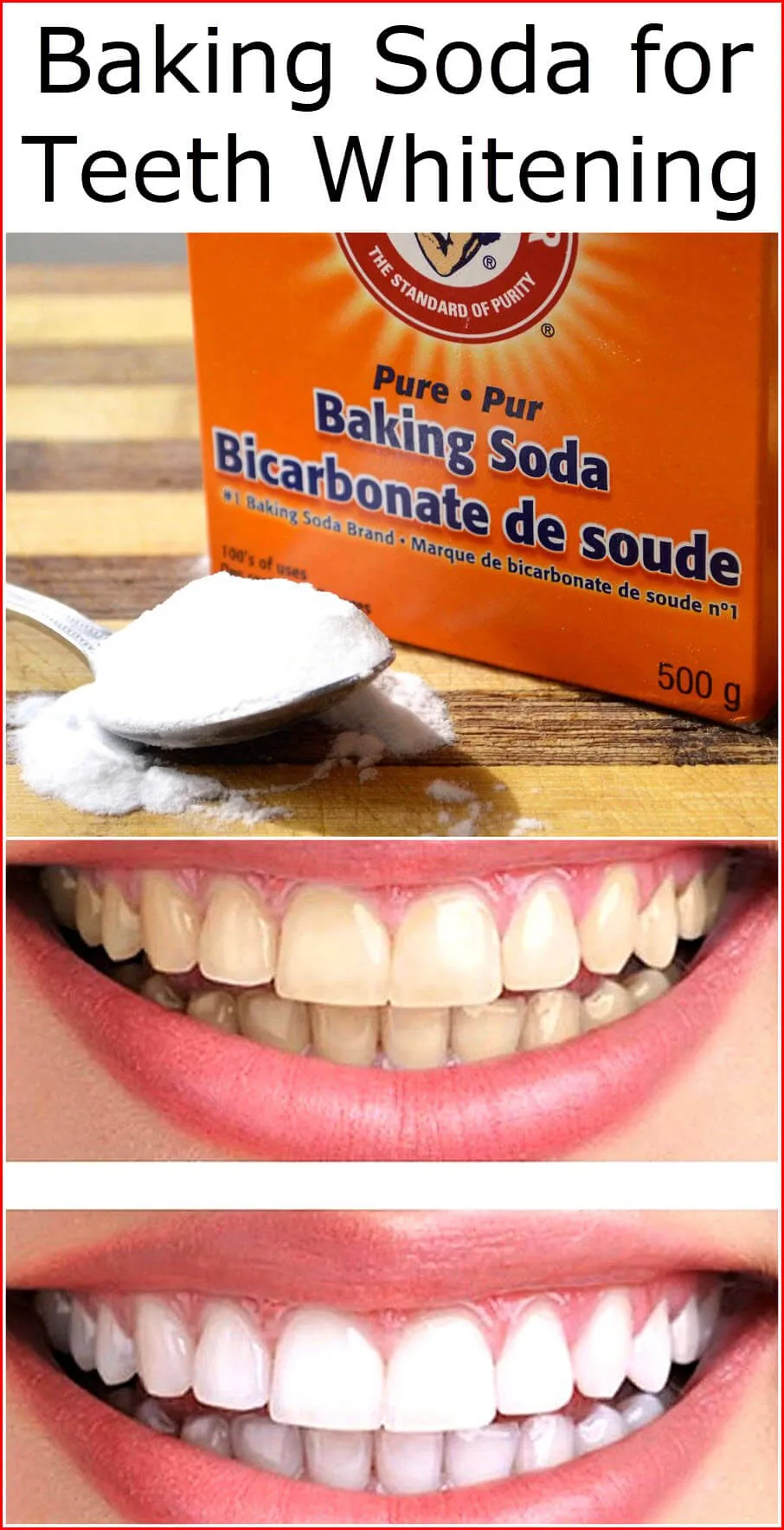 33037 white smile