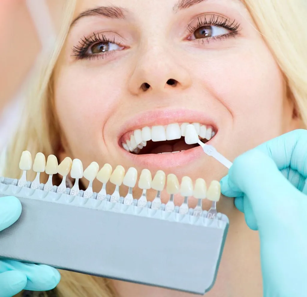 33039 teeth whitening sharjah home kit