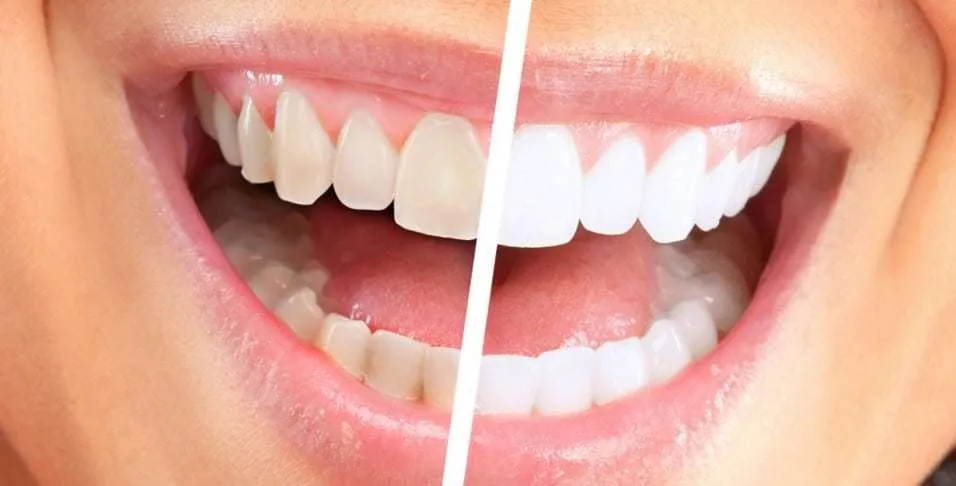 33043 tooth sensitivity
