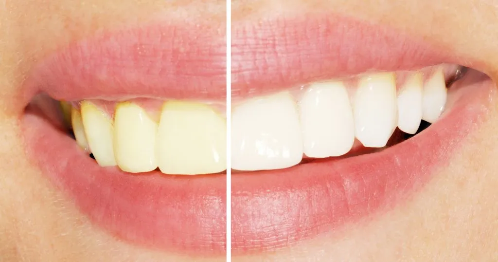 /img/33044-encino-dentist-consultation.webp