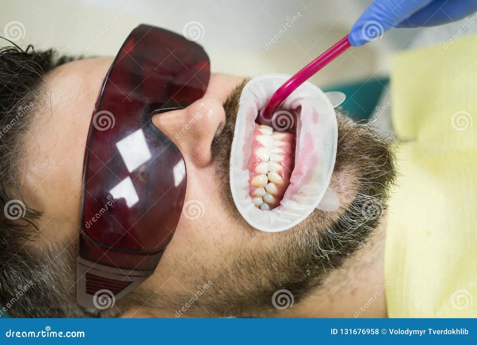 33049 healthy smile with whitening