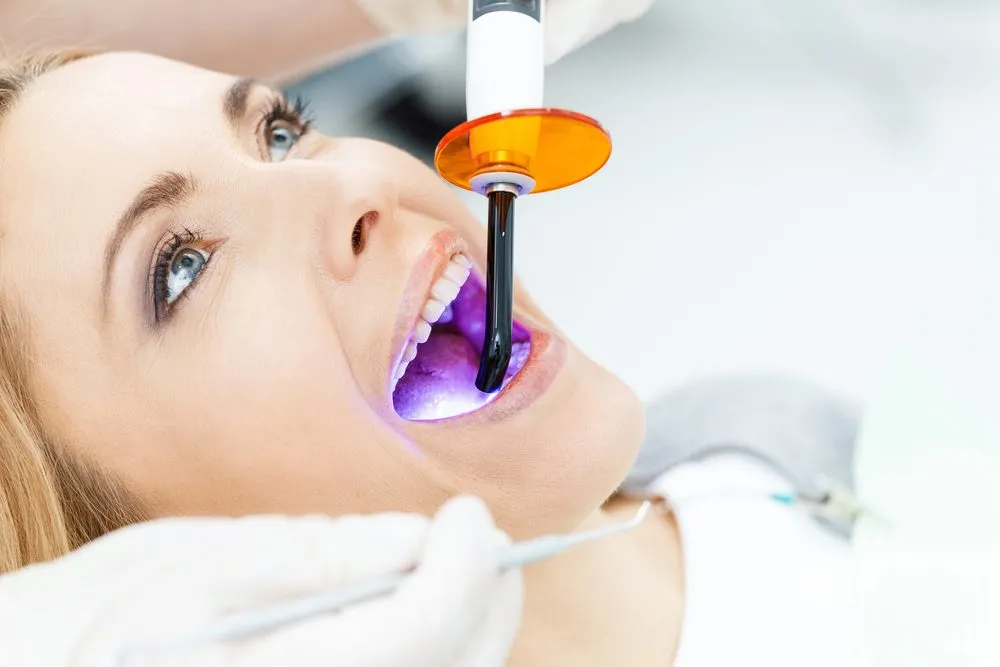 33049 teeth whitening results
