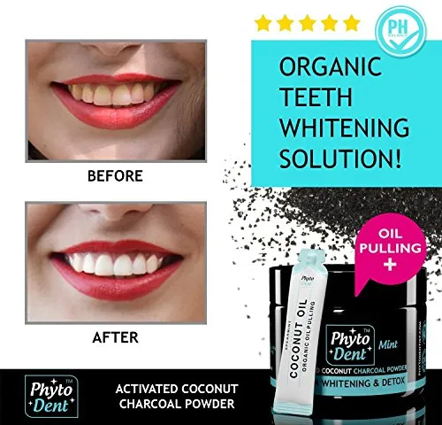 33053 gentle teeth whitening