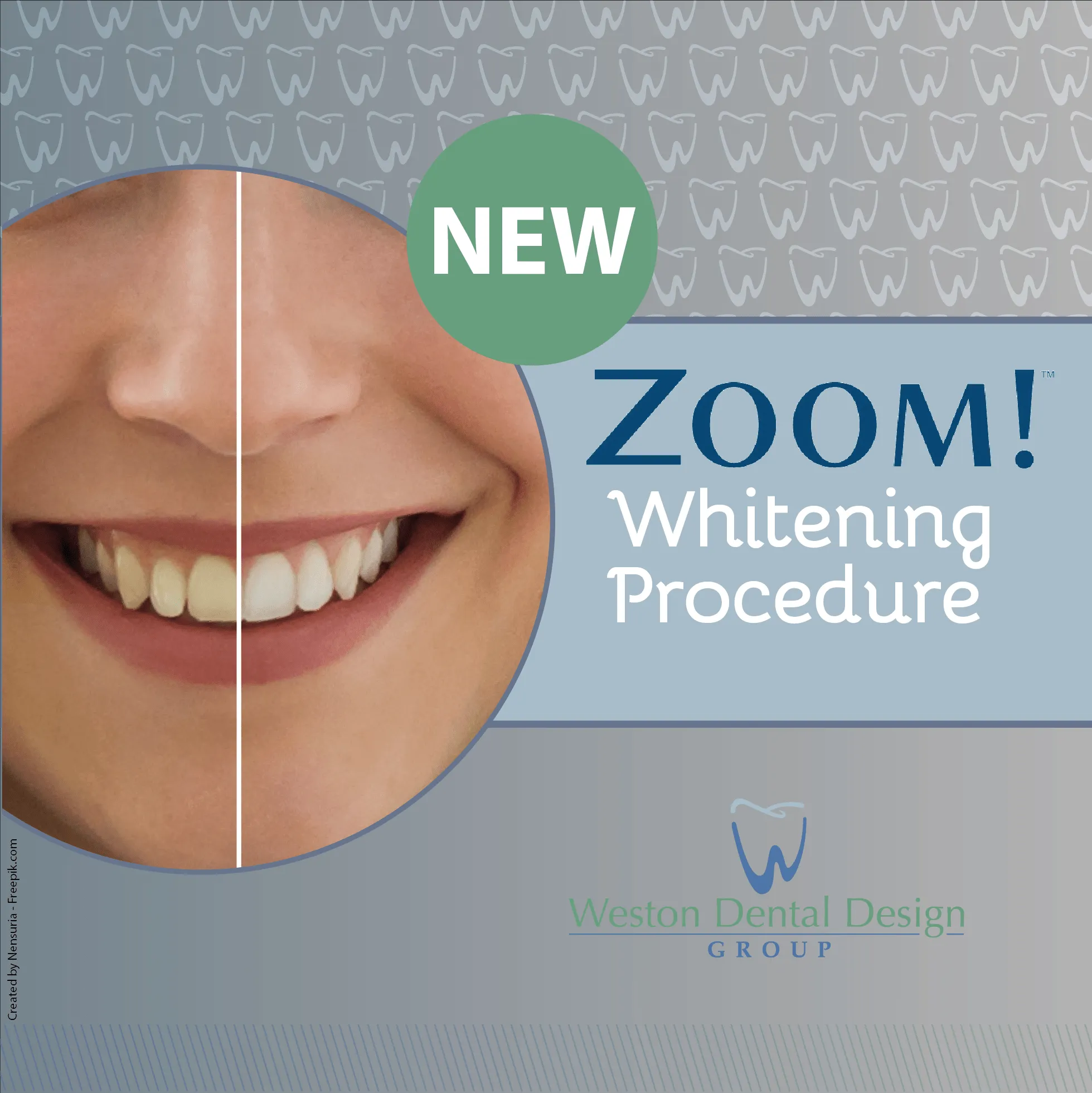 33054 zoom whitening procedure