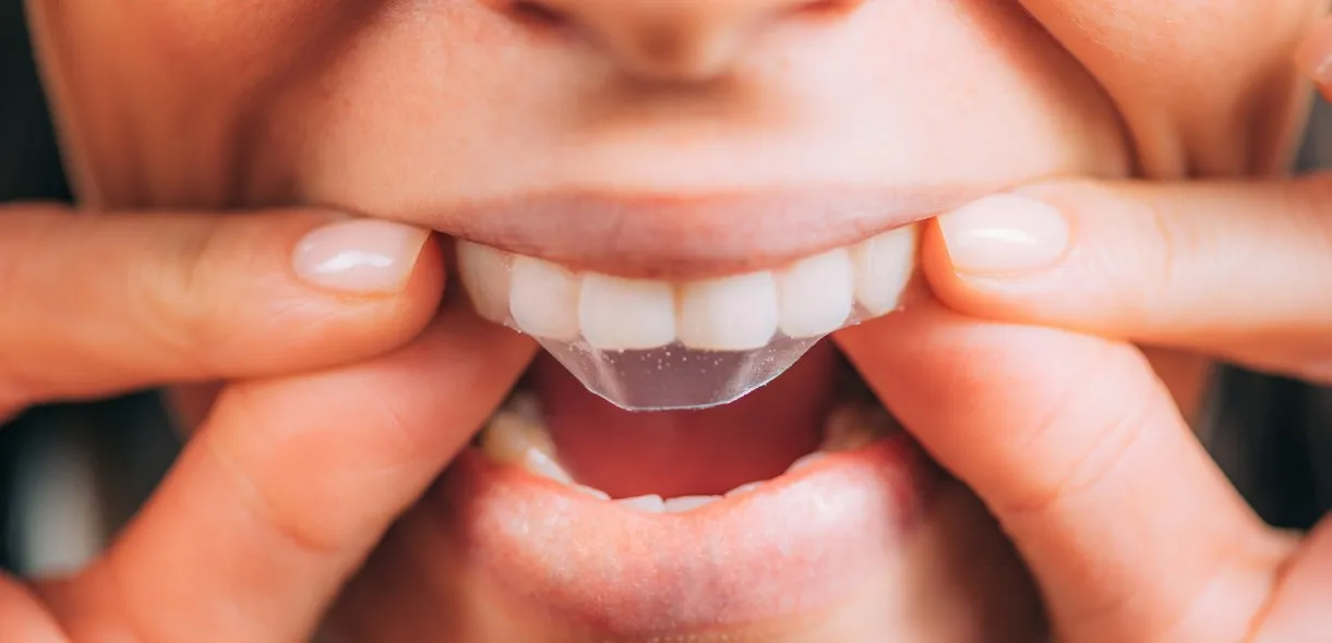 /img/33056-long-term-whitening.webp