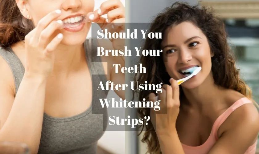 33056 teeth brushing before whitening