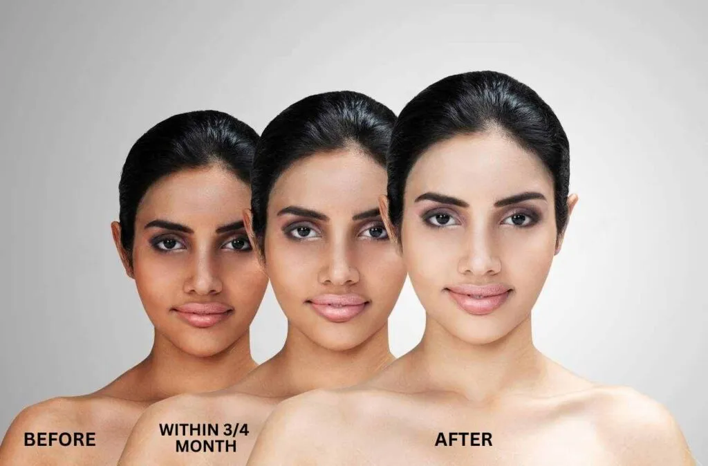 /img/33062-post-treatment-skin-care.webp