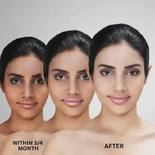 /img/33062-post-treatment-skin-care.webp
