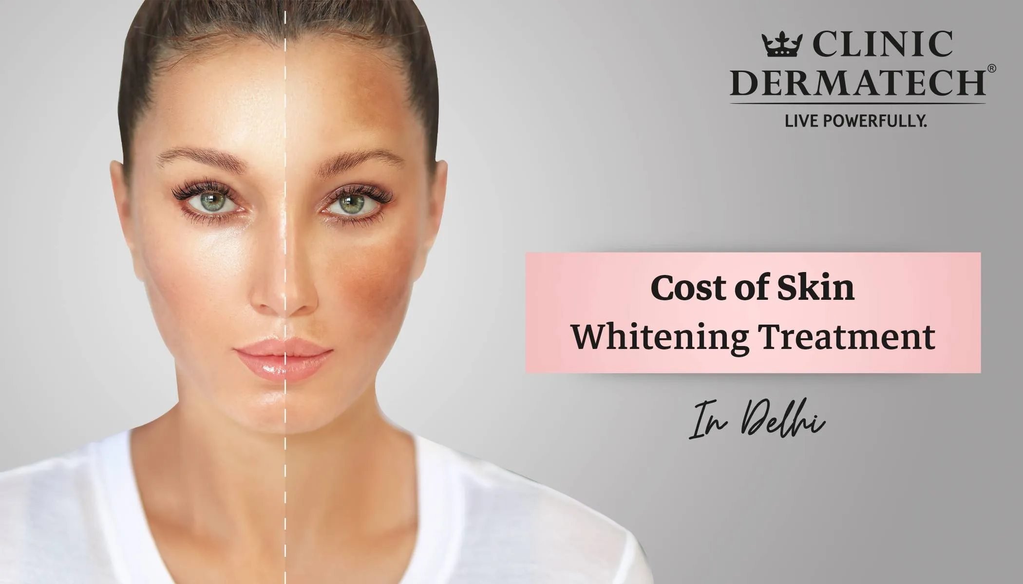 33062 skin whitening creams delhi