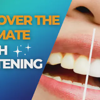 /img/33068-teeth-whitening-aftercare.webp