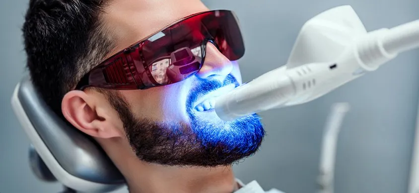 33070 teeth whitening maintenance