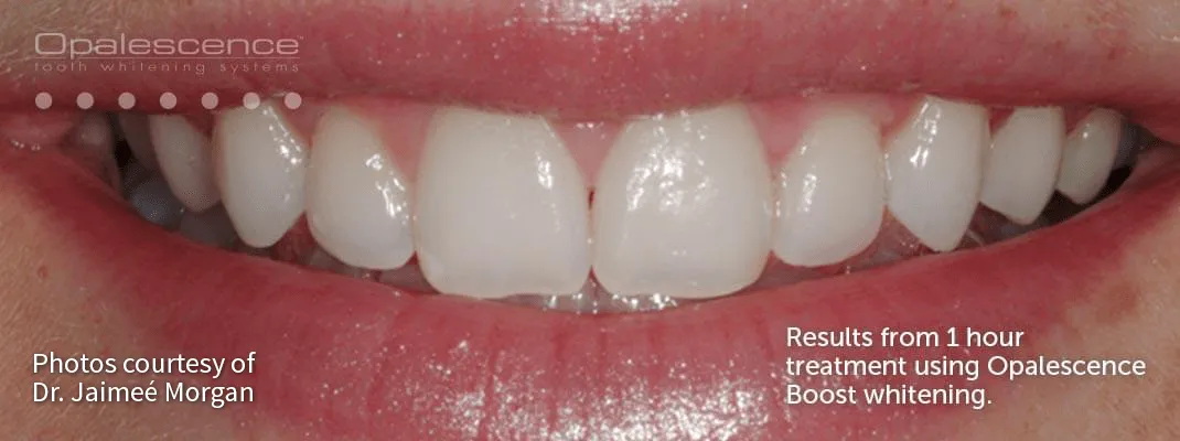 /img/33072-oral-hygiene.webp