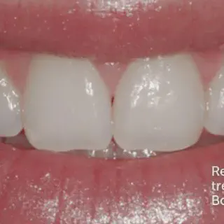 /img/33072-oral-hygiene.webp