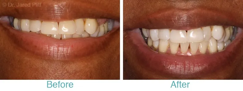 /img/33077-miami-dentist-smile.webp