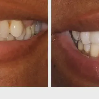 /img/33077-miami-dentist-smile.webp