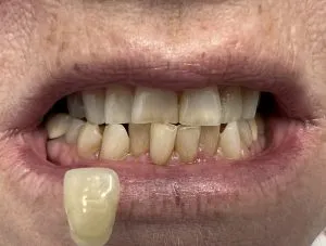 33078 teeth whitening oral health