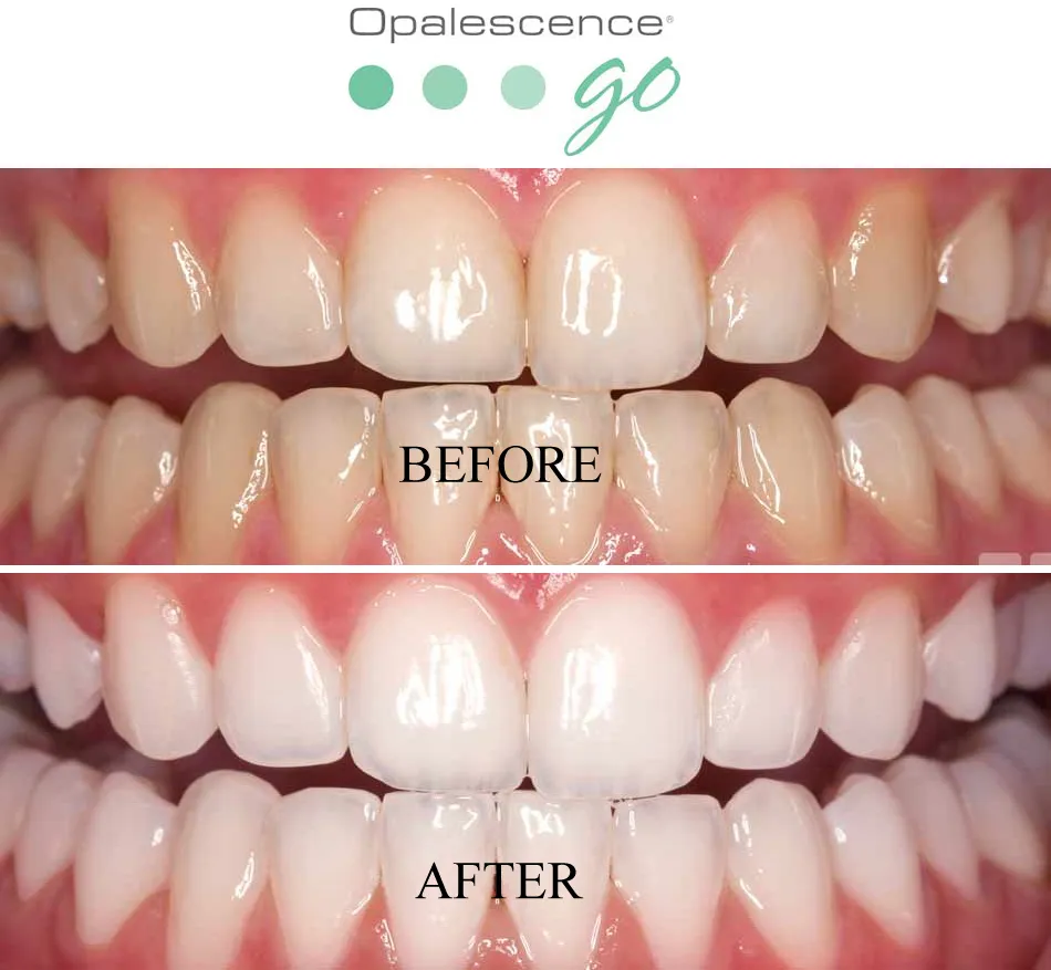 33079 opalescence go application