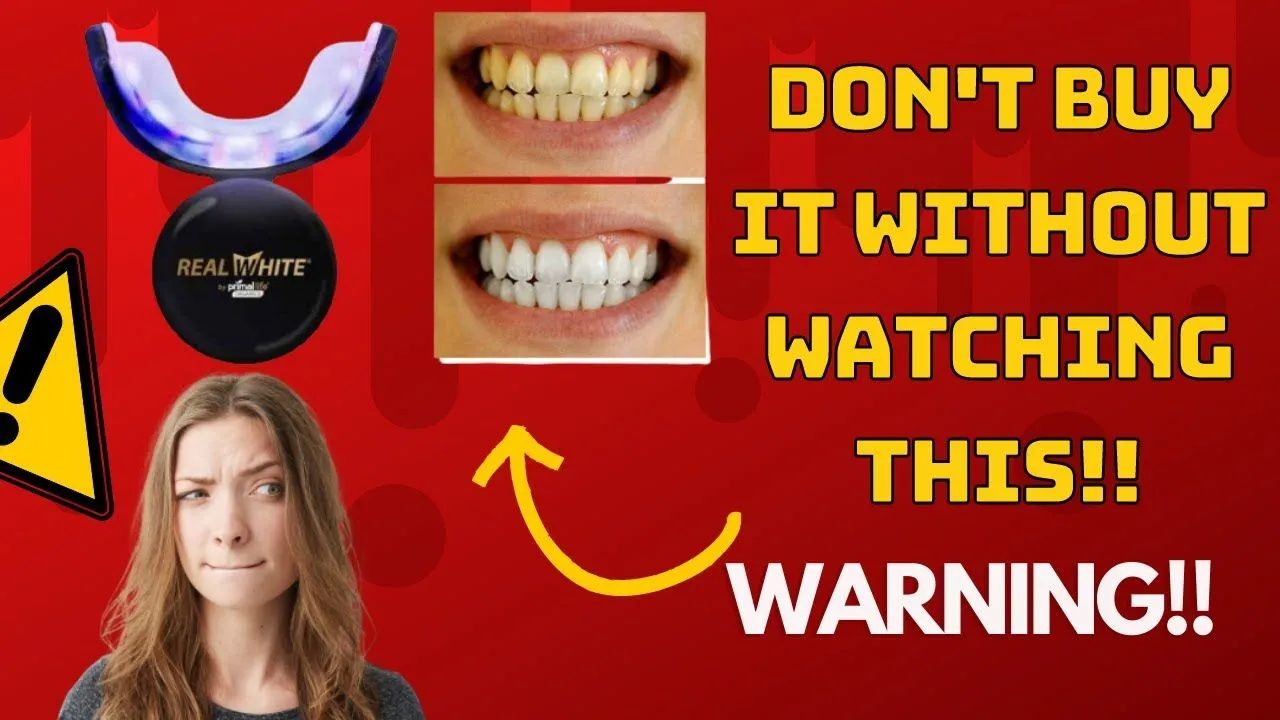 33081 teeth whitening alternatives