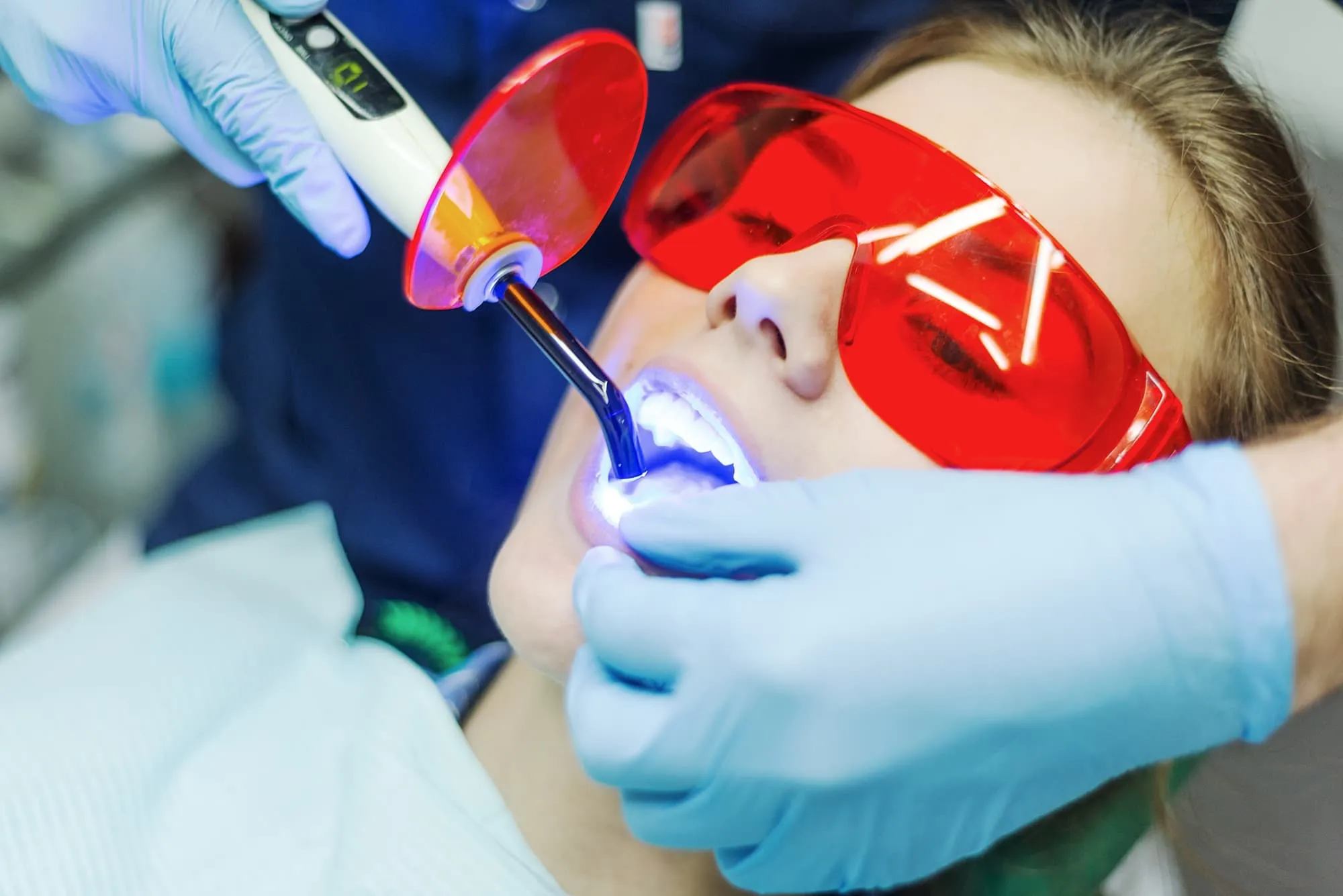 33086 teeth whitening cost