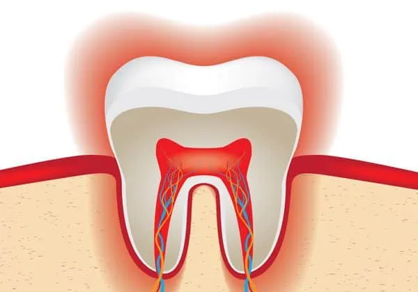 33087 choosing whitening method