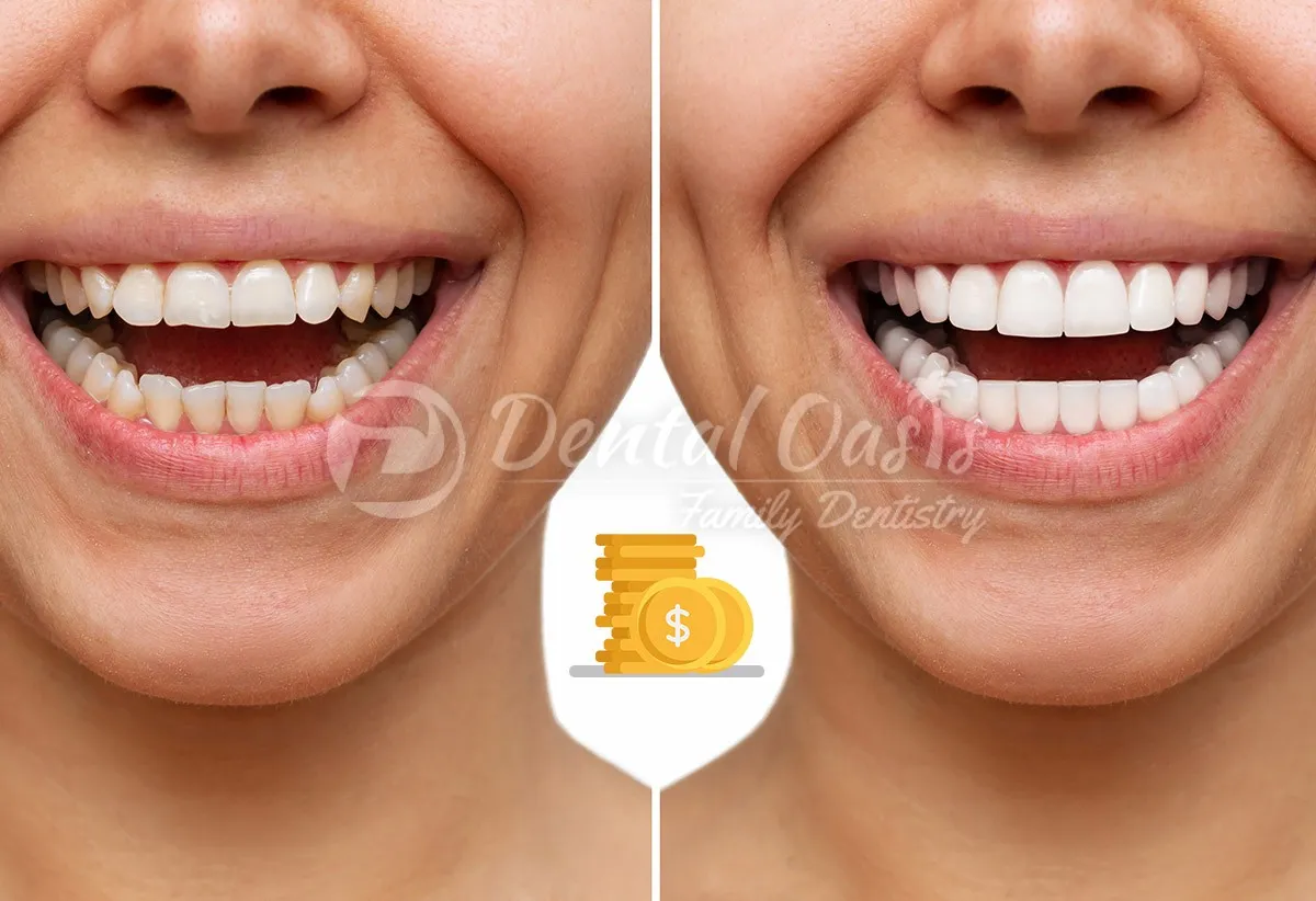 /img/33089-oral-hygiene-tips.webp