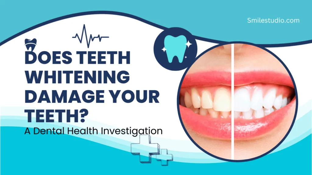 33090 teeth whitening treatment