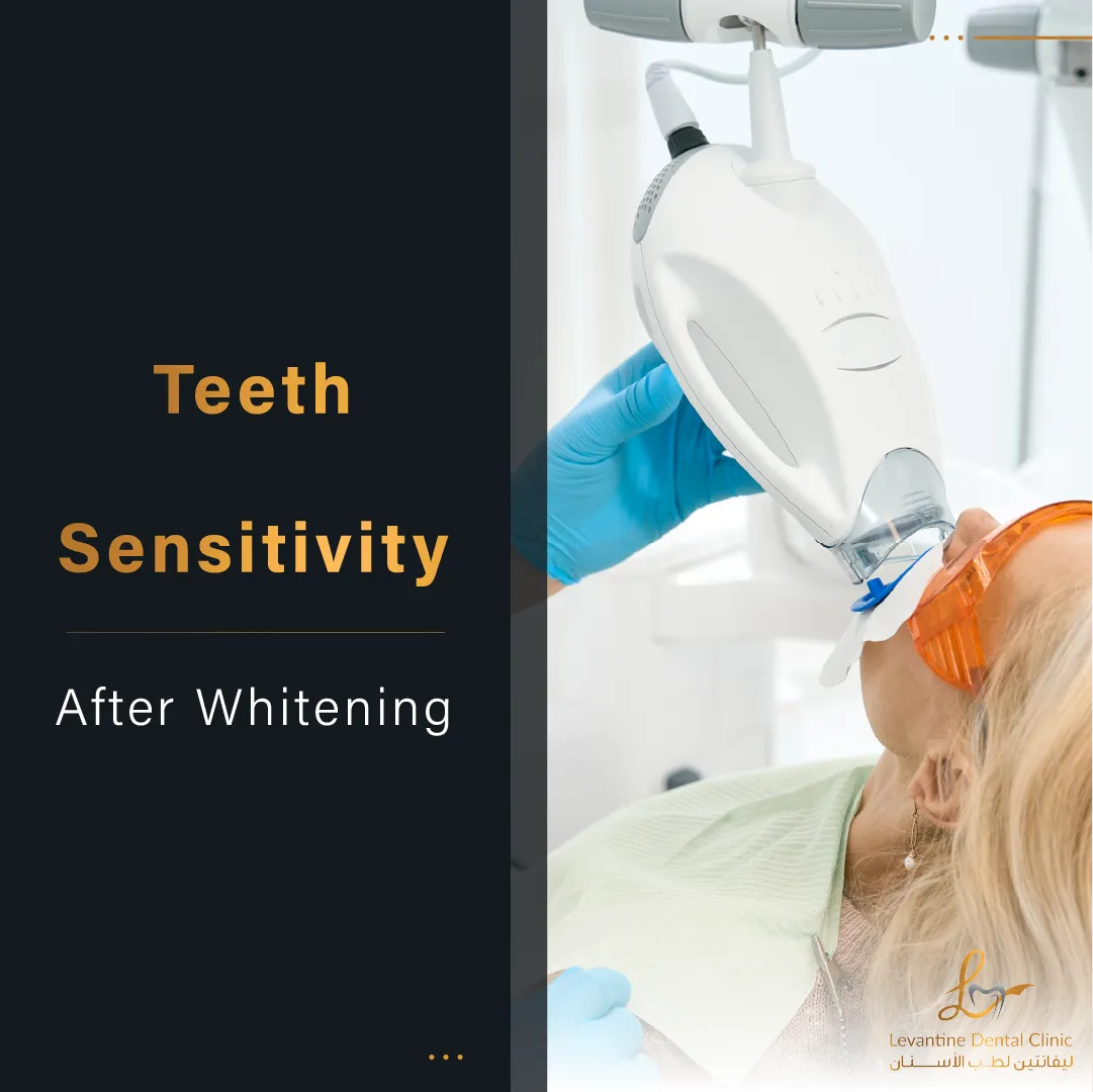/img/33094-dental-veneers.webp