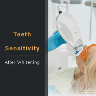 /img/33094-dental-veneers.webp