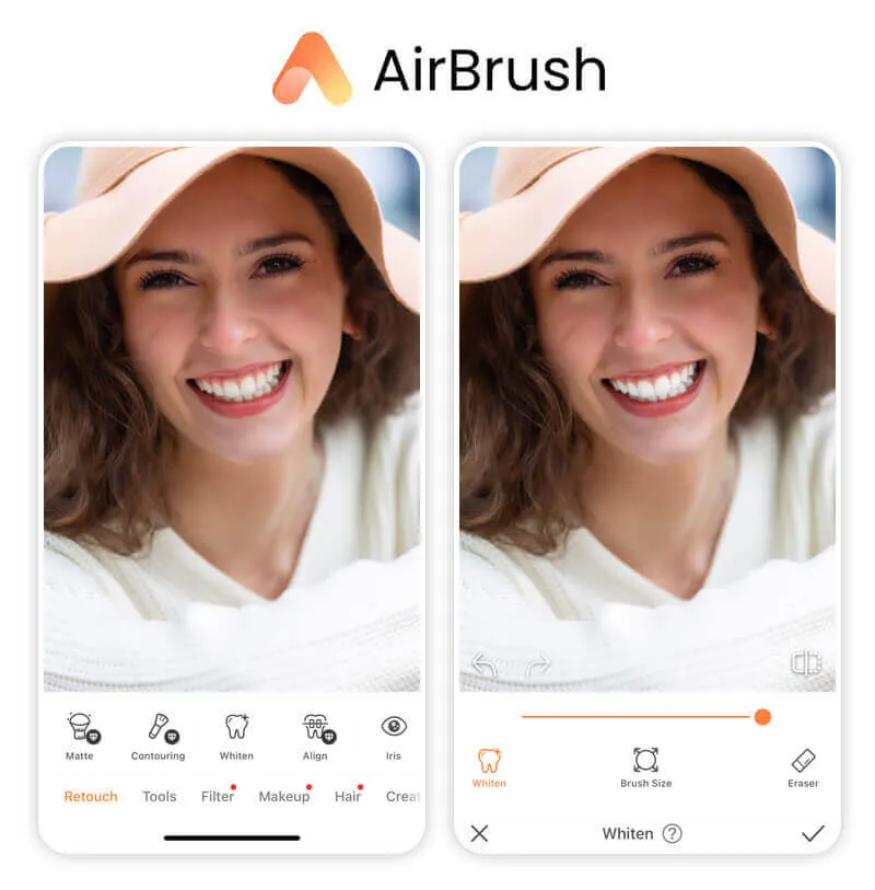 33099 color correction teeth
