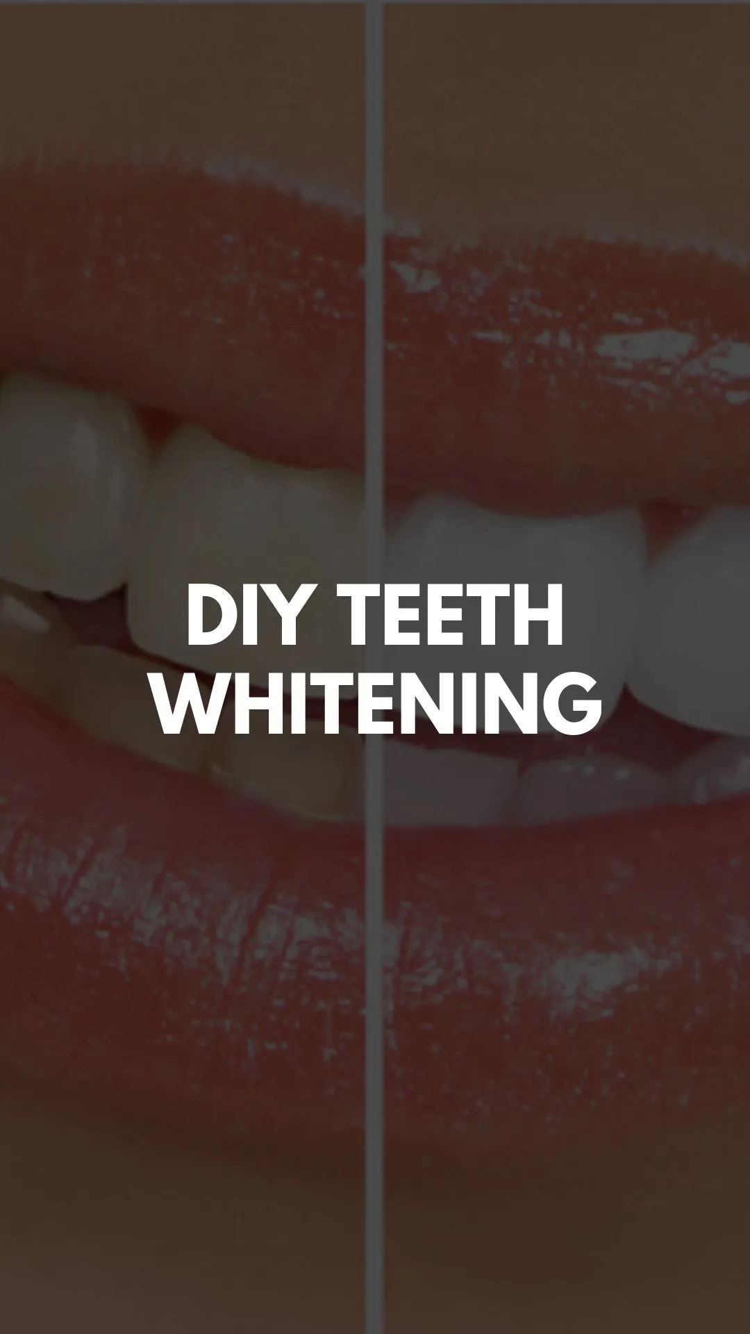 /img/33102-professional-whitening-vs-diy.webp